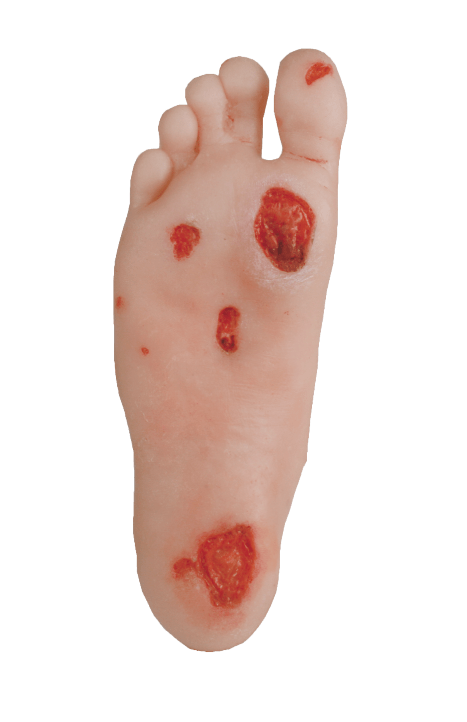 RUCK - Lehrmodell Diabetes-Fuß