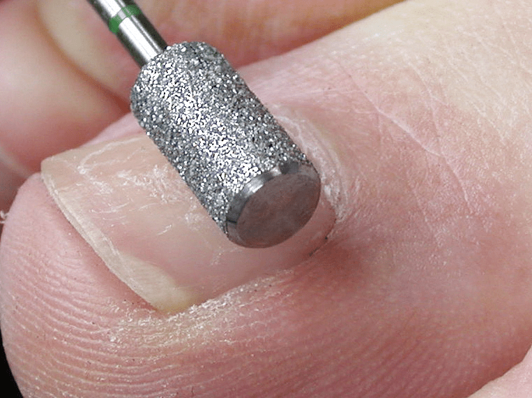 BUSCH - Diamantschleifer SIDE Grip